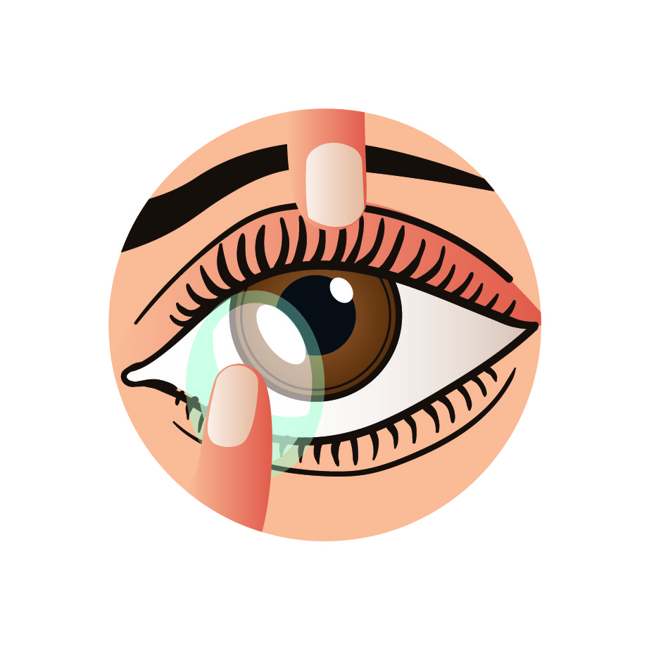 How to wear contact lenses - Place the lens on your cornea